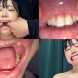 nko07-1：よだれダラダラすずちゃんの口内観察
